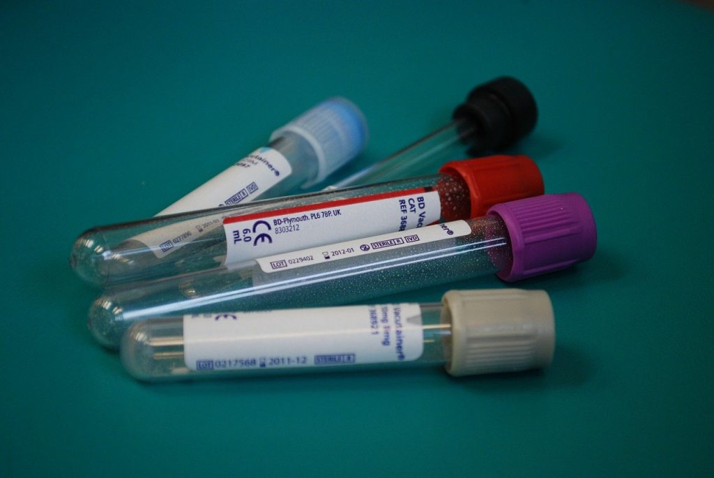 ampolas para coleta material de laborat&oacute;rio Foto: Pixabay